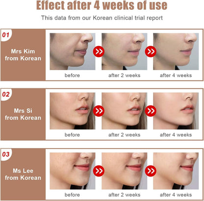 Microcurrent Face Lifting Massager